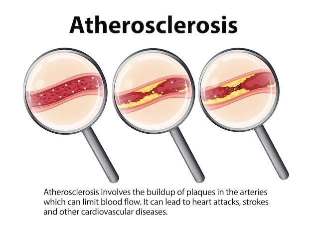 Overview of Hyperkeratosis Lenticularis Perstans of Flegel