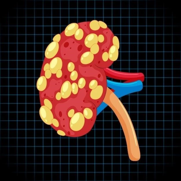 Understanding Neuroma Biliary Tract: Types, Causes, Symptoms, Diagnosis, and Treatment