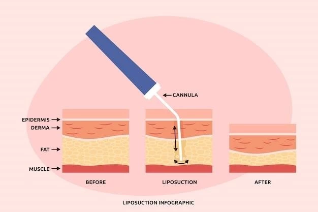 Comprehensive Plan on Aplasia Cutis