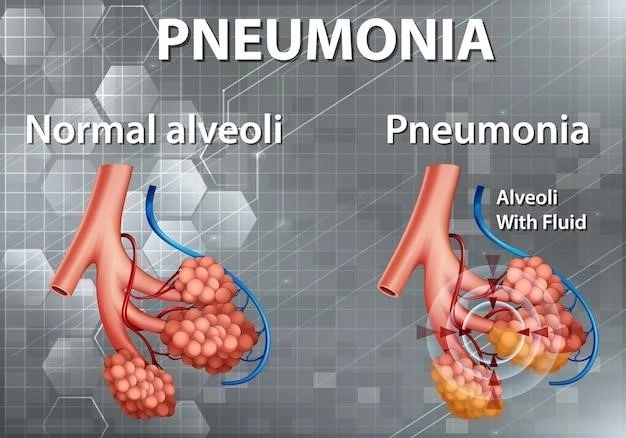 Overview of Prinzmetals Variant Angina