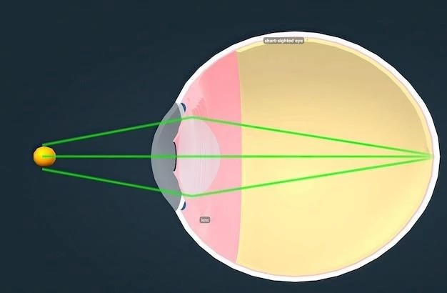 Overview of Oculo-auriculo-vertebral Spectrum