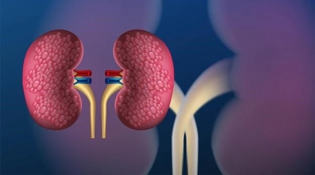 Understanding Nephrocalcinosis: Causes, Symptoms, and Treatment