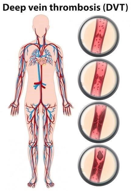 Overview of Vascular Purpura