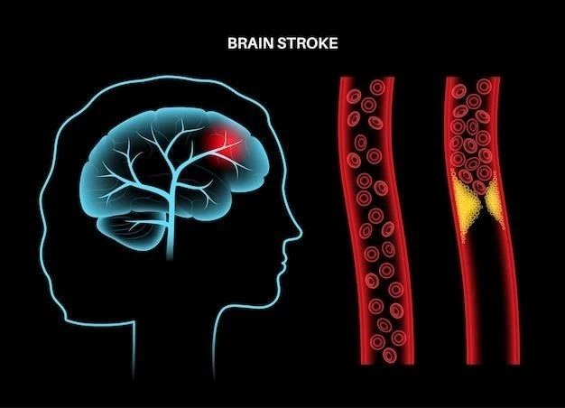 Disease ౼ Intracranial Aneurysms Multiple Congenital Anomaly