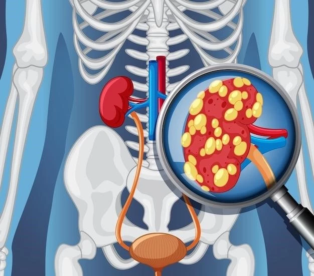 Understanding and Managing Fanconi Syndrome with Renal Nephrocalcinosis and Renal Stones