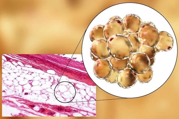 Understanding Roch-Leri Mesosomatous Lipomatosis