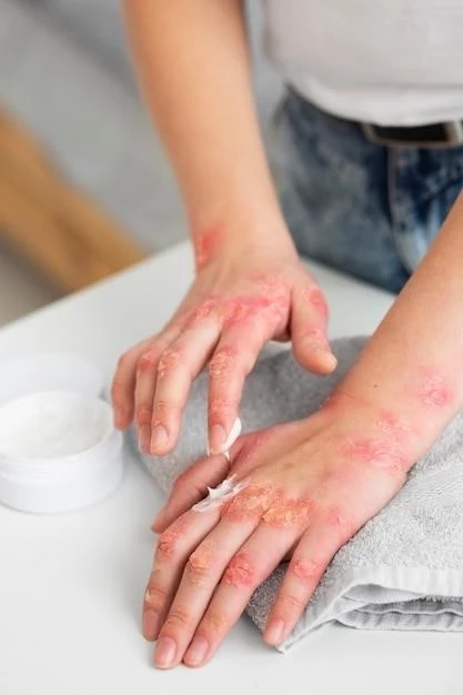 Understanding Exfoliative Dermatitis