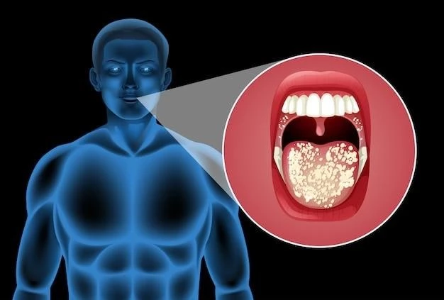 Disease Overview: Ichthyosis and Male Hypogonadism