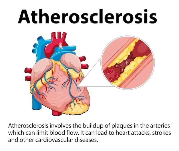 Overview of Persistent Truncus Arteriosus: Causes, Symptoms, and Treatment