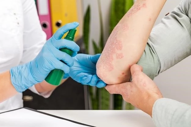 Understanding Palmoplantar Keratoderma: Types, Symptoms, and Treatment